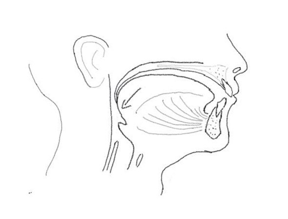 Maxillo-mandibular advancement (MMA)