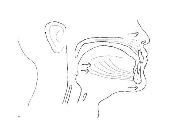 Maxillo-mandibular advancement (MMA)